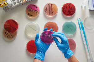 Laboratorio Biotecnología Hospital de Alta Resolución de Utrera. Sevilla APESBG